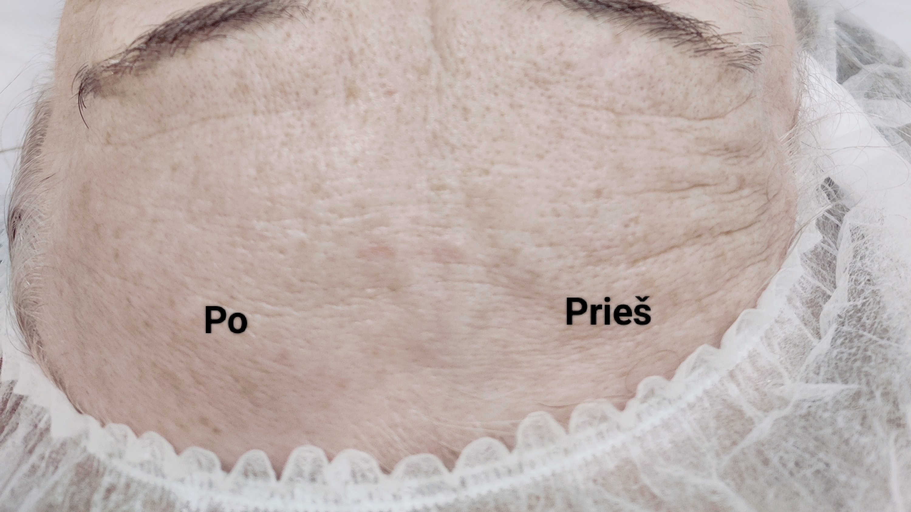 Kakta – prieš ir po