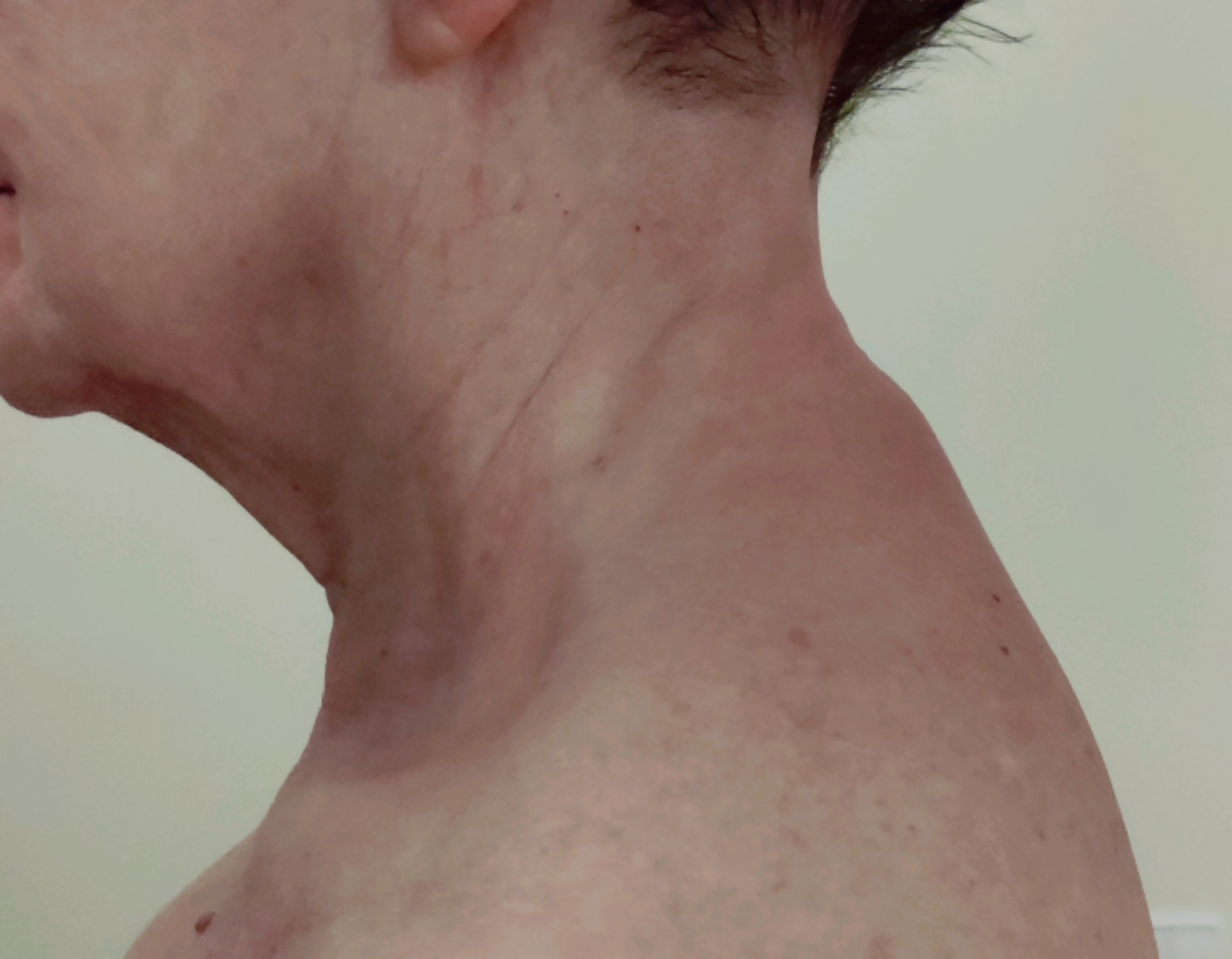 Pečiai ir kaklas po