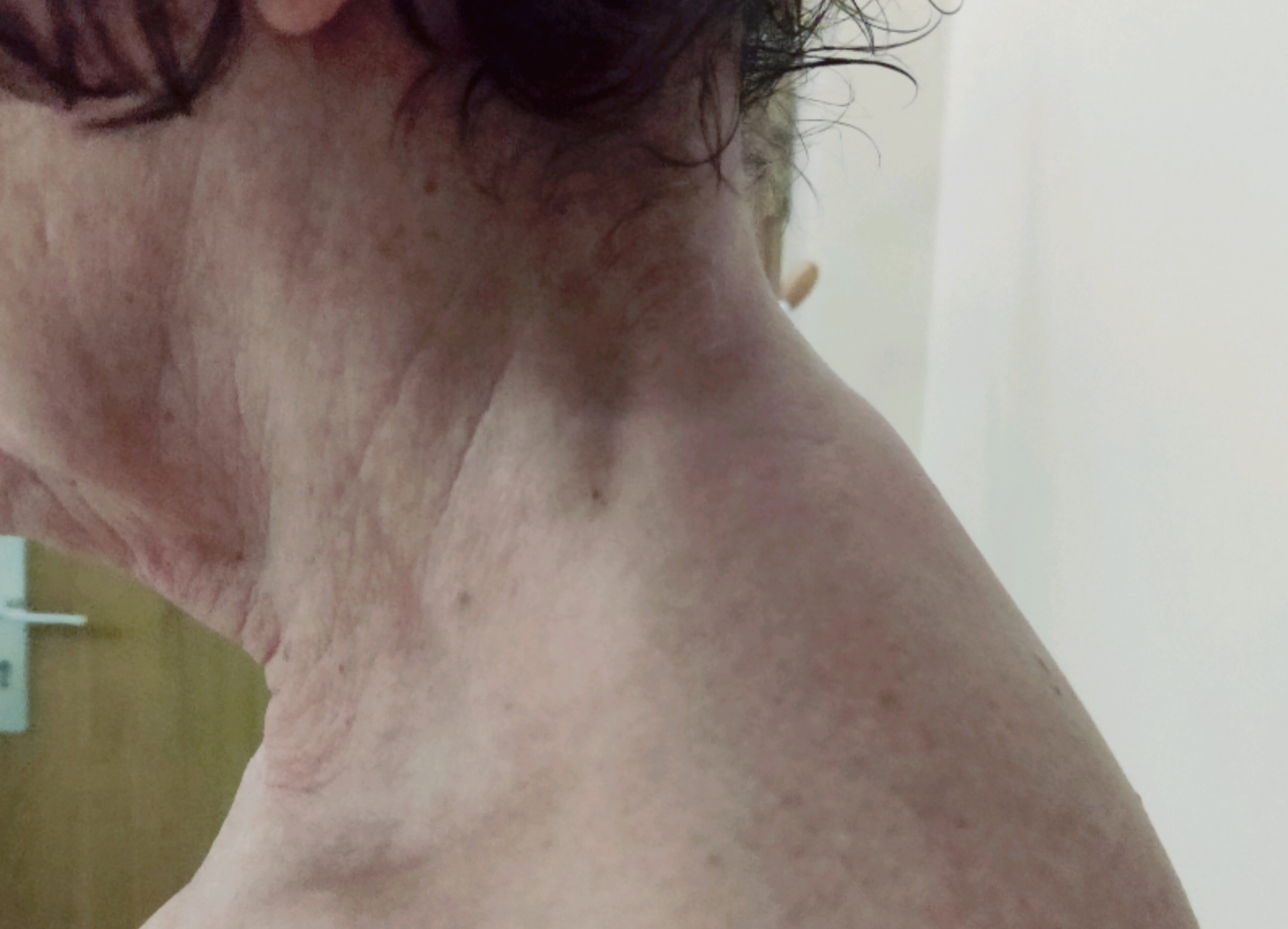 Pečiai ir kaklas prieš